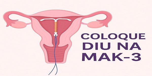 COLOQUE SEU DIU NA MAK-3